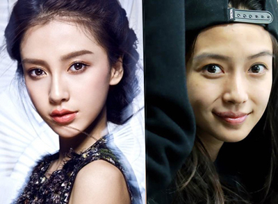 微整箍牙 你不知道的那些明星