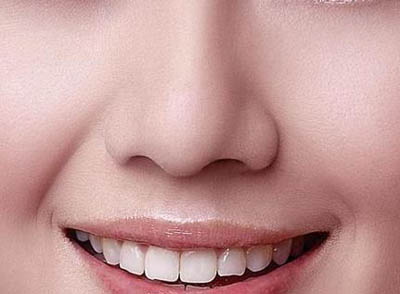 整形小手术 鼻翼缩小方法有哪些呢