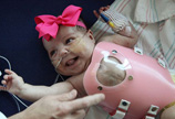 美女婴心脏长体外手术后平安出院