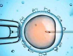 做试管婴儿的条件 试管婴儿多少钱