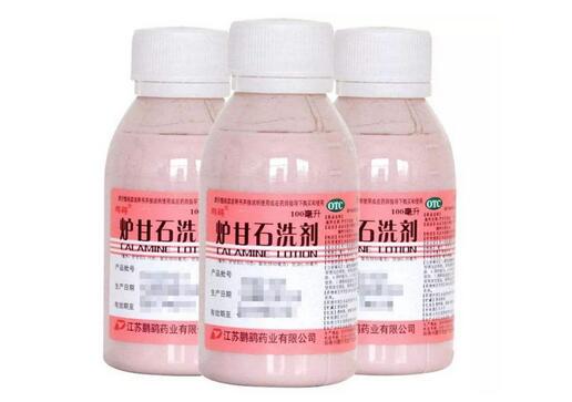 炉甘石洗剂孕妇能用吗