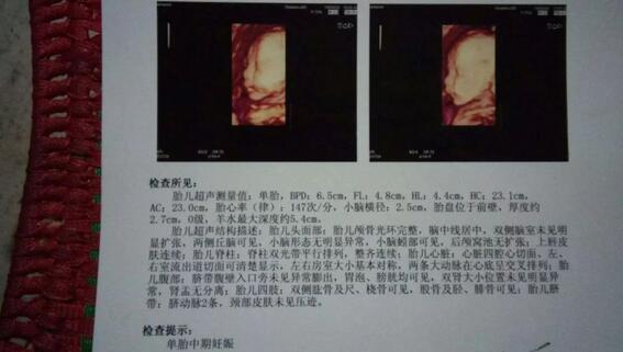 孕期征兆暗示你生男孩!