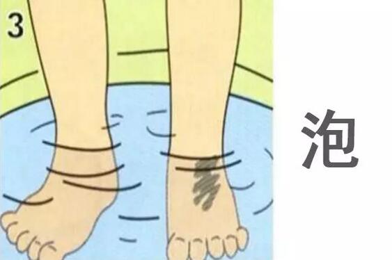 孩子烫伤后怎么处理？先脱衣服是还是先冲水？