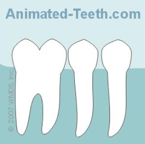 孩子出现双排牙,是否和食物太精细有关?