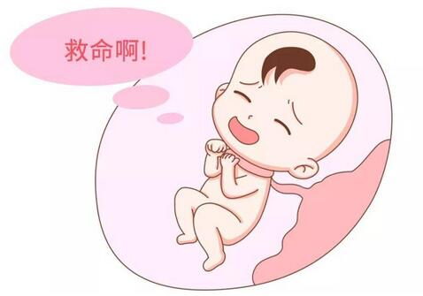 新生儿窒息