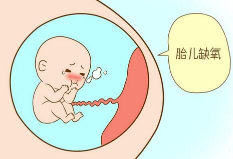 新生儿窒息
