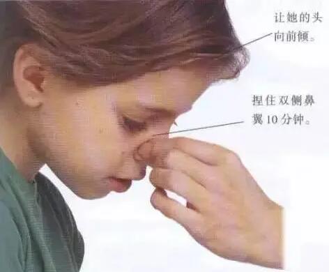 小孩流鼻血了，第一步该怎么办？