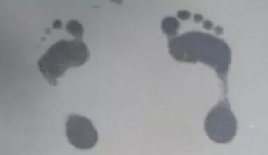 扁平足怎么判断 扁平足的危害