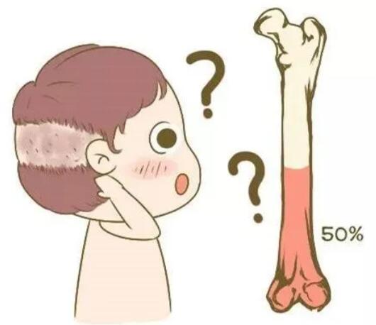 婴儿出现枕秃了?是缺钙了吗?