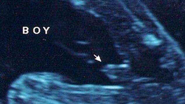 四维彩超怎么看男女怎么看