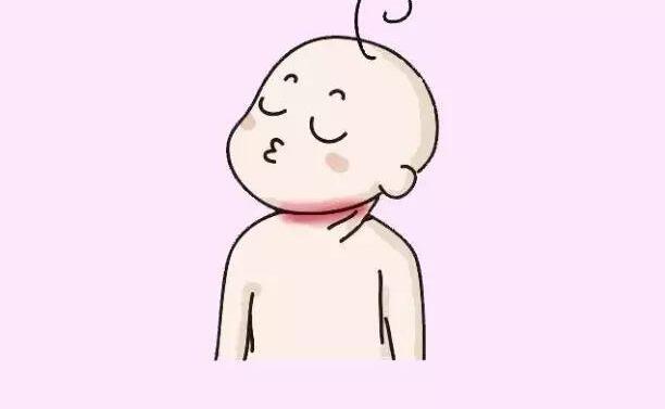 夏天宝宝淹脖子,发红又破皮怎么办?