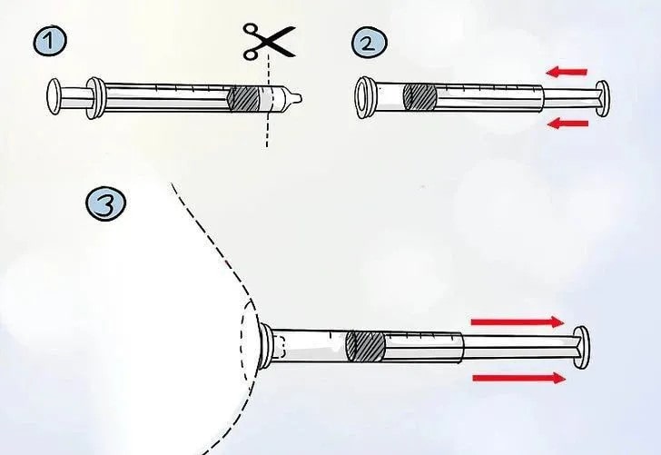 乳头内陷怎么办