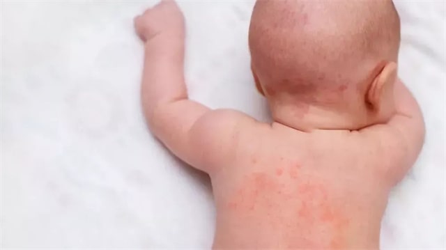 新生婴幼儿洗澡多长时间洗一次澡？