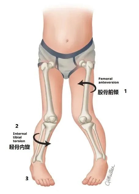 孩子W坐有危害吗 正确的坐姿什么样