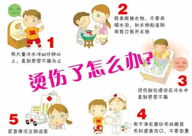 宝宝烫伤怎么办 烫伤处理五字诀