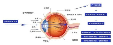 保护孩子的眼睛，从补充叶黄素开始