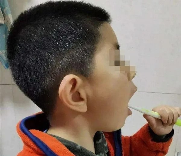 儿童换牙注意事项，需注意这5个方面