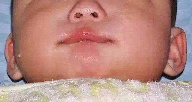 宝宝总爱咬下嘴唇,有危害吗?