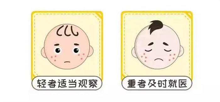 宝宝牛奶蛋白过敏有哪些表现?