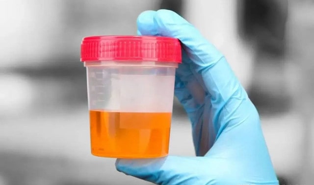 手把手教你测排卵试纸怎么用