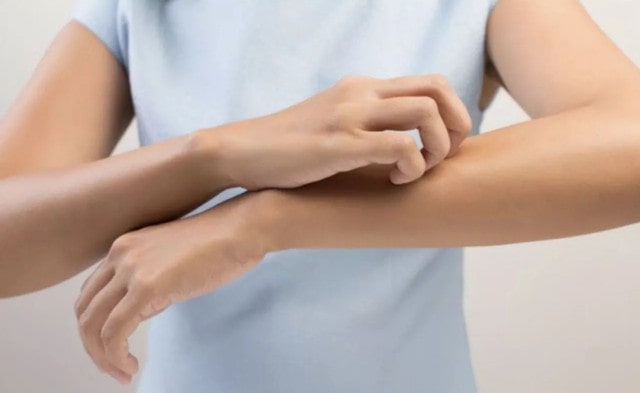 孕期皮肤过敏怎么办？